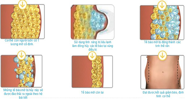 Cơ chế giảm mỡ nhiệt lạnh Cooltech Define