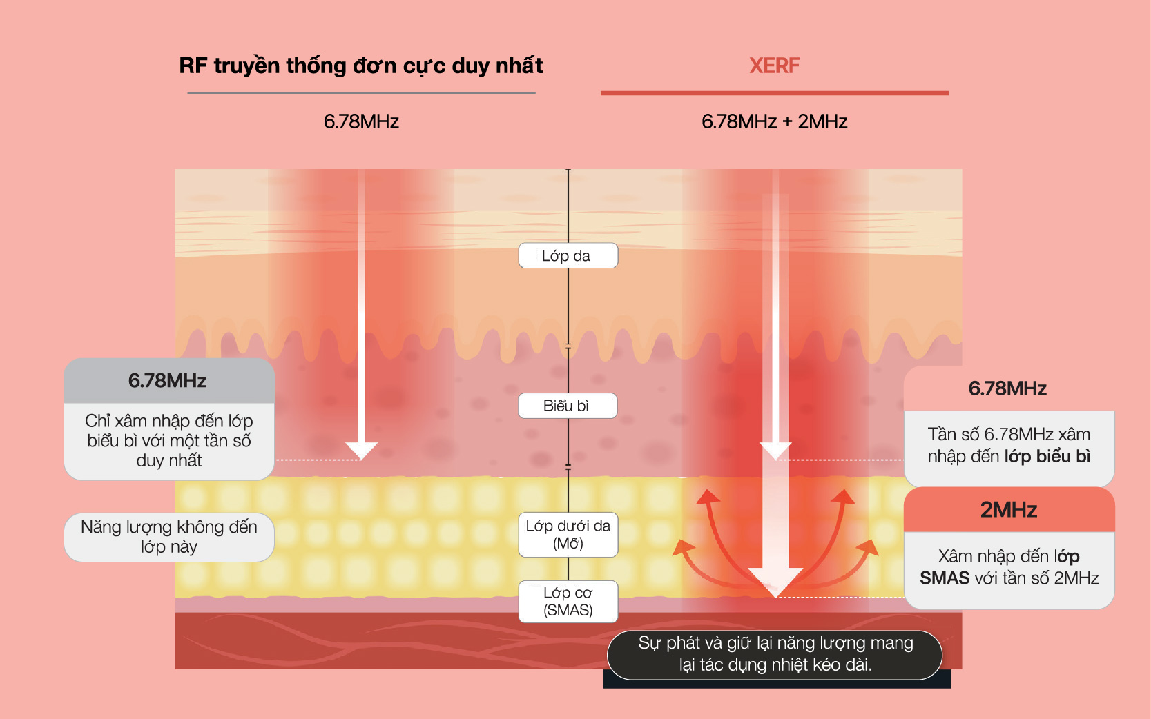 Tần số kép độc quyền 6.78 + 2MHz & Kỹ thuật 3 độ sâu